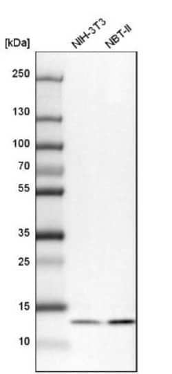 UQCRB Antibody, Novus Biologicals:Antibodies:Primary Antibodies